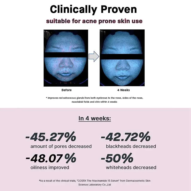 Cosrx-The-Niacinamide-15-Serum-Ορός-Υψηλής-Συγκέντρωσης-15%-σε-Νιασιναμίδη-20ml-12 Cosrx The Niacinamide 15 Serum Ορός Υψηλής Συγκέντρωσης 15% σε Νιασιναμίδη 20ml